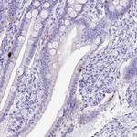 PRAMEF19 Antibody in Immunohistochemistry (Paraffin) (IHC (P))