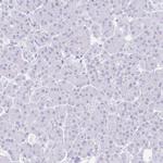 SUZ12 Antibody in Immunohistochemistry (Paraffin) (IHC (P))