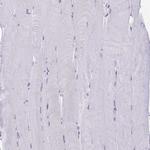 SUZ12 Antibody in Immunohistochemistry (Paraffin) (IHC (P))