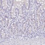 SUZ12 Antibody in Immunohistochemistry (Paraffin) (IHC (P))
