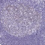 SUZ12 Antibody in Immunohistochemistry (Paraffin) (IHC (P))