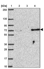 SUZ12 Antibody in Western Blot (WB)