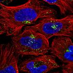 VPS26A Polyclonal Antibody