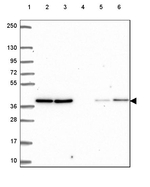 VPS26A Antibody in Western Blot (WB)