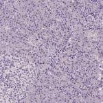 TMEM16B Polyclonal Antibody