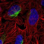 ZCCHC9 Antibody in Immunocytochemistry (ICC/IF)