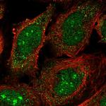 Cerebral Protein 1 Polyclonal Antibody