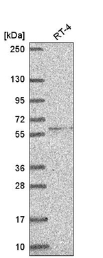 Cerebral Protein 1 Antibody in Western Blot (WB)
