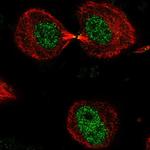 DNHD1 Polyclonal Antibody