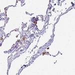 Tartrate Resistant Acid Phosphatase Antibody in Immunohistochemistry (Paraffin) (IHC (P))