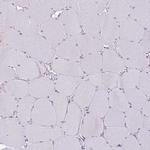 Tartrate Resistant Acid Phosphatase Antibody in Immunohistochemistry (Paraffin) (IHC (P))