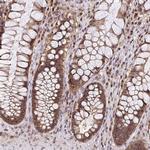 UBE2M Antibody in Immunohistochemistry (Paraffin) (IHC (P))