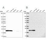 UBE2M Antibody in Western Blot (WB)