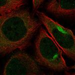 PKN2 Polyclonal Antibody