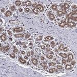 PKN2 Antibody in Immunohistochemistry (Paraffin) (IHC (P))