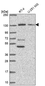 PKN2 Antibody in Western Blot (WB)