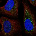 FYCO1 Polyclonal Antibody