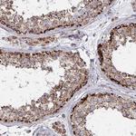 PEX3 Polyclonal Antibody