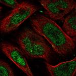 FAM193B Polyclonal Antibody