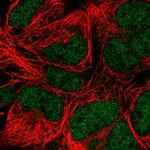 POLE Polyclonal Antibody