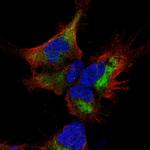 SESTD1 Polyclonal Antibody