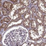 IMMP1L Polyclonal Antibody