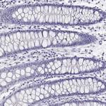 BHMT Antibody in Immunohistochemistry (Paraffin) (IHC (P))