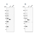 BHMT Antibody in Western Blot (WB)