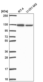 ARS2 Antibody in Western Blot (WB)