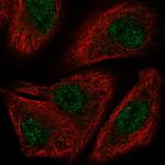 TOX2 Polyclonal Antibody