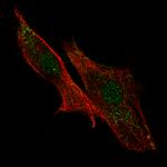 GARP Polyclonal Antibody