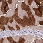 TNNT1 Polyclonal Antibody