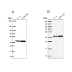 RFC4 Antibody in Western Blot (WB)