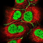 HLA-DPB1 Polyclonal Antibody