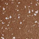 SIRP alpha Antibody in Immunohistochemistry (Paraffin) (IHC (P))