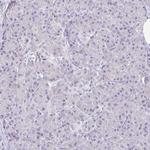 SIRP alpha Antibody in Immunohistochemistry (Paraffin) (IHC (P))