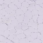 SIRP alpha Antibody in Immunohistochemistry (Paraffin) (IHC (P))