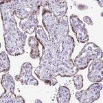 CMPK1 Antibody in Immunohistochemistry (Paraffin) (IHC (P))