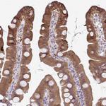 CMPK1 Antibody in Immunohistochemistry (Paraffin) (IHC (P))