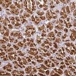 CMPK1 Antibody in Immunohistochemistry (Paraffin) (IHC (P))