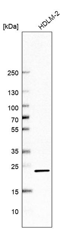 CMPK1 Antibody in Western Blot (WB)