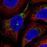 GTPBP8 Polyclonal Antibody