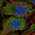 DCP1B Polyclonal Antibody