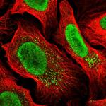 MYCBP2 Polyclonal Antibody