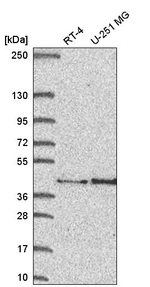 FAM107B Antibody in Western Blot (WB)