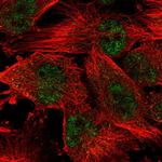 WDR19 Polyclonal Antibody