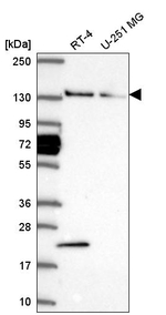 WDR19 Antibody in Western Blot (WB)