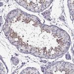 FAM92A1 Antibody in Immunohistochemistry (Paraffin) (IHC (P))