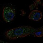 KRT25 Polyclonal Antibody