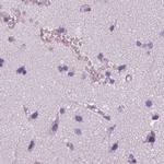 KRT25 Antibody in Immunohistochemistry (Paraffin) (IHC (P))